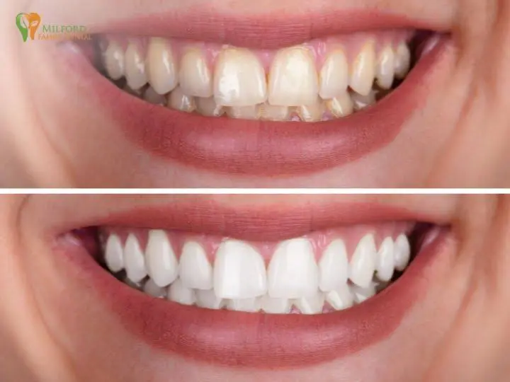 Milford Family Dental