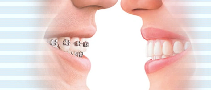 Class One Orthodontics