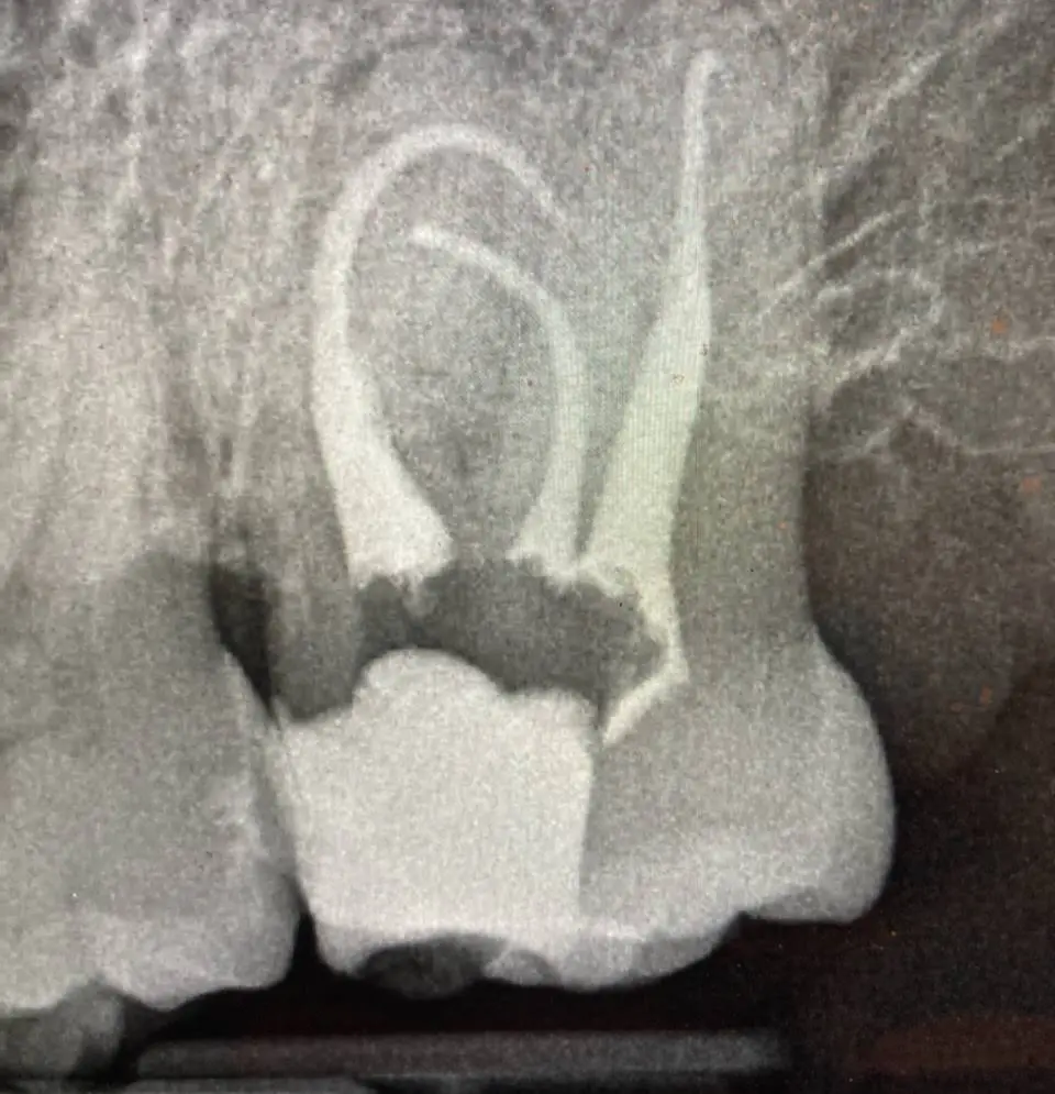 Blackstone Endodontics: Mariya Shnaydman, DMD, MDS
