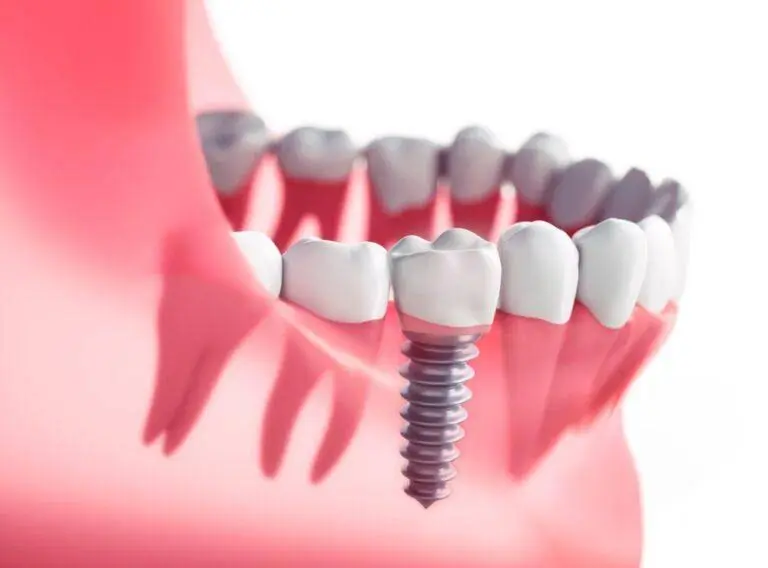 Chestnut Dental