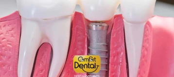 Comfort Dental