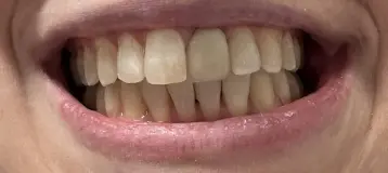 Family Orthodontics of Hudson