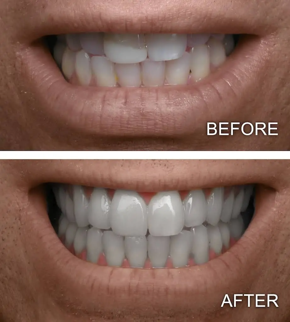 Star Smile Dental & Implant Center