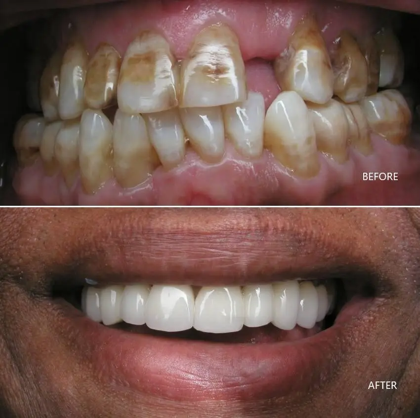 Star Smile Dental & Implant Center