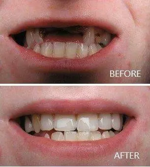 Star Smile Dental & Implant Center