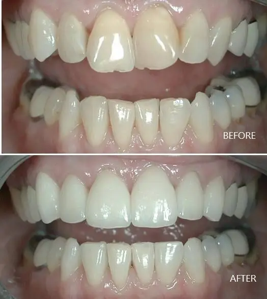 Star Smile Dental & Implant Center