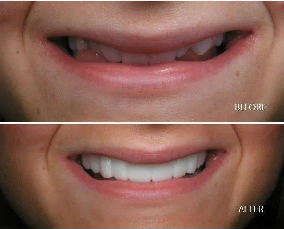 Star Smile Dental & Implant Center