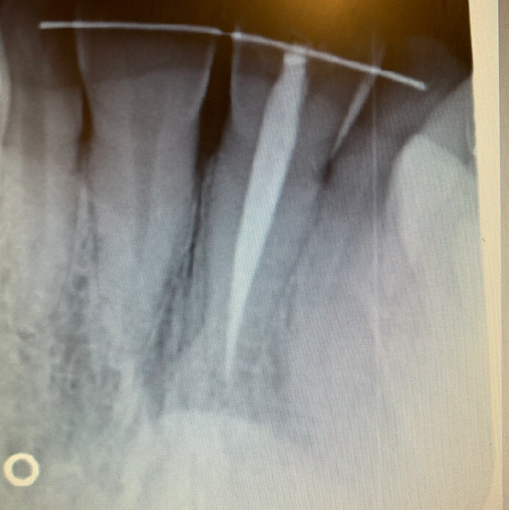 iLove Dental Care