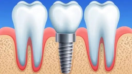 Vagenas Dental