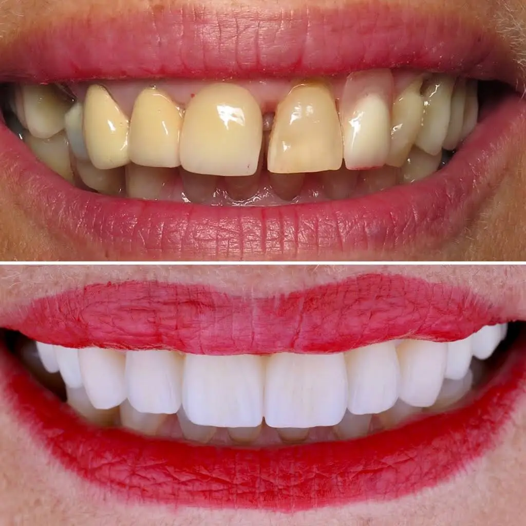 FIXT Dental