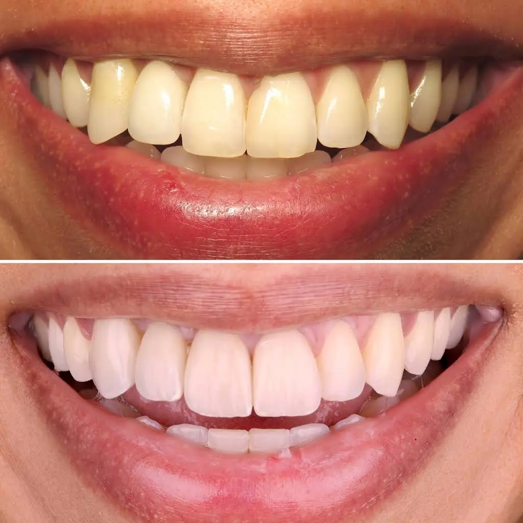 FIXT Dental