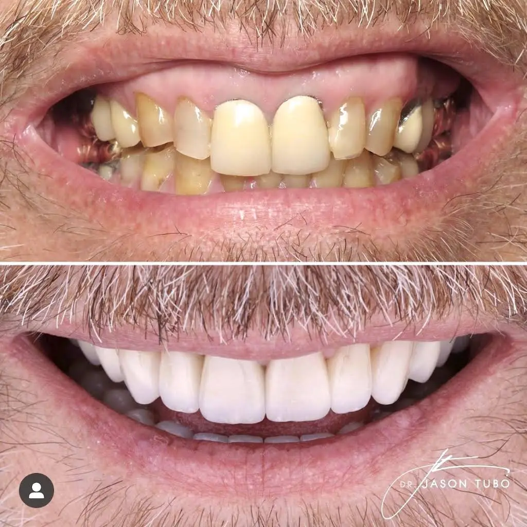 FIXT Dental