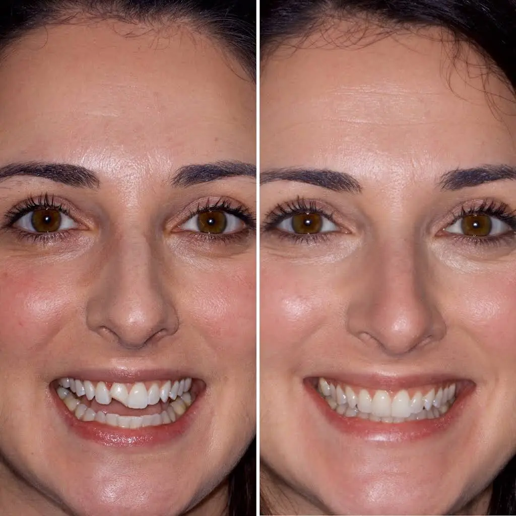 FIXT Dental