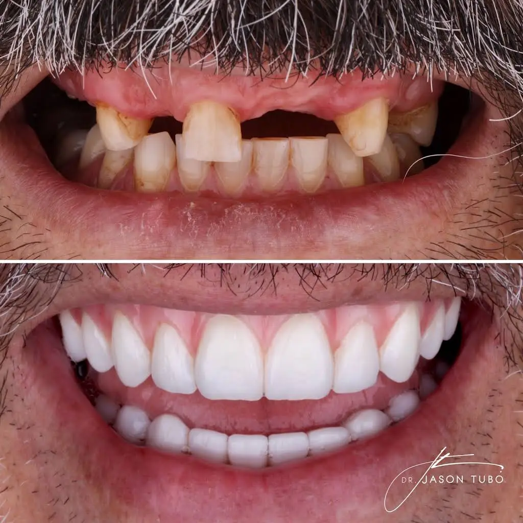 FIXT Dental