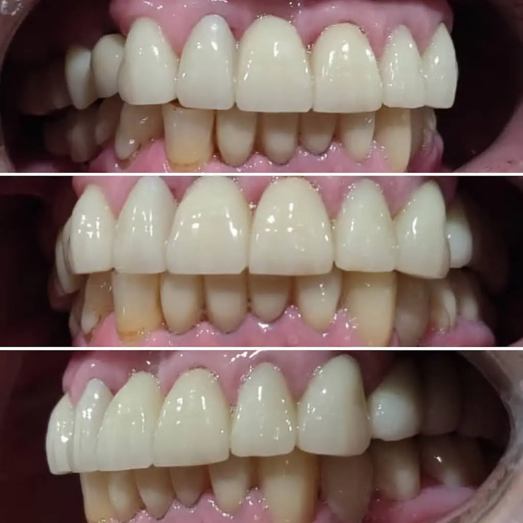 Q Smile Dental Spa