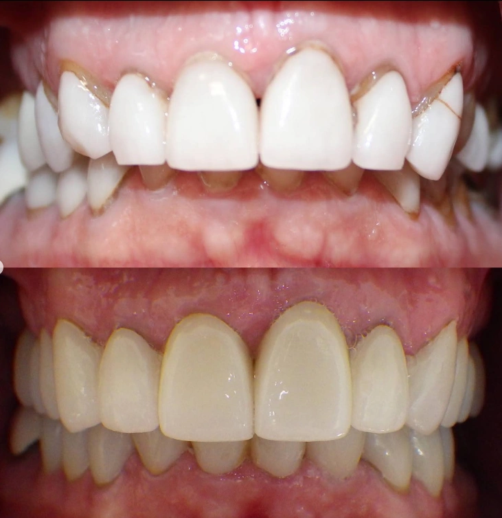 Brede Ciapciak Dental