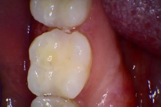 Simply Orthodontics Wayland