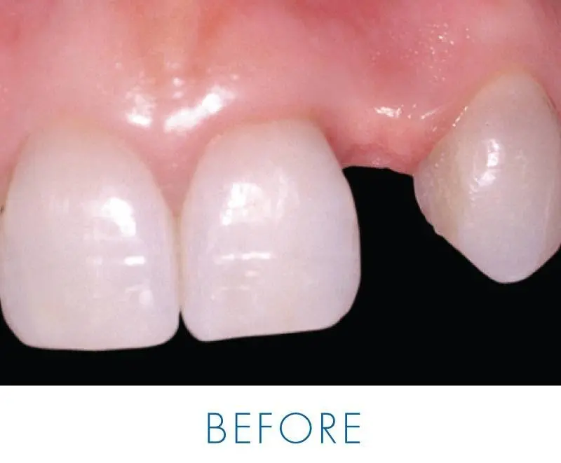 Implant Dentistry Centre