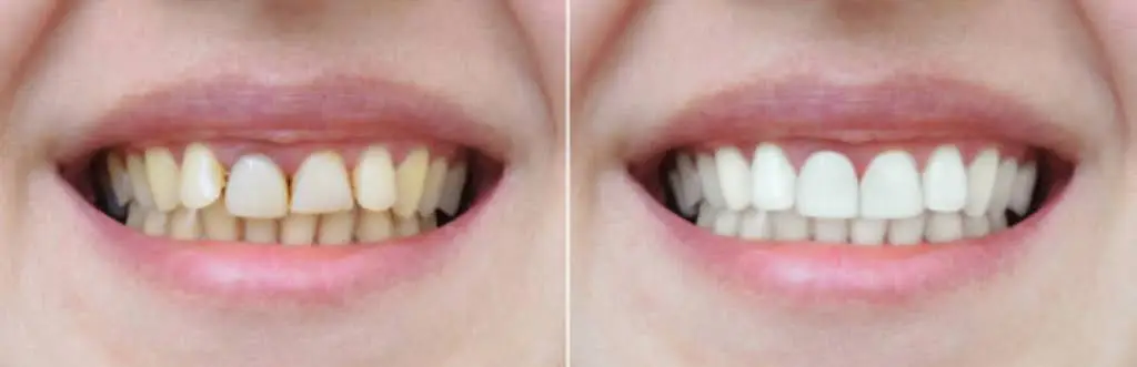 Ace Dental Group