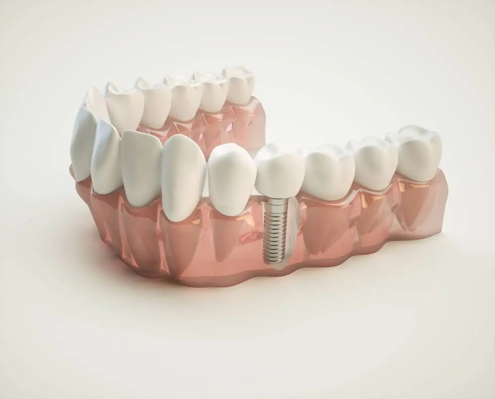 Chestnut Hill Dental Associates
