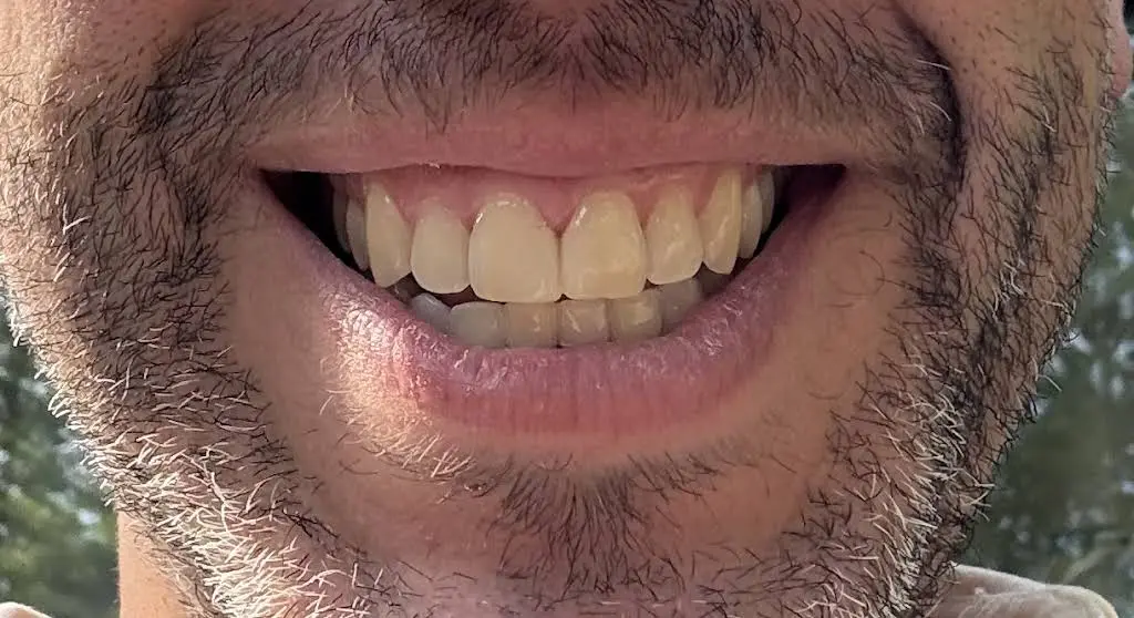 Cleveland Circle Dental Associates