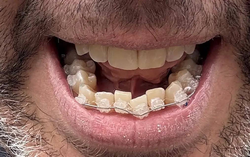Cleveland Circle Dental Associates