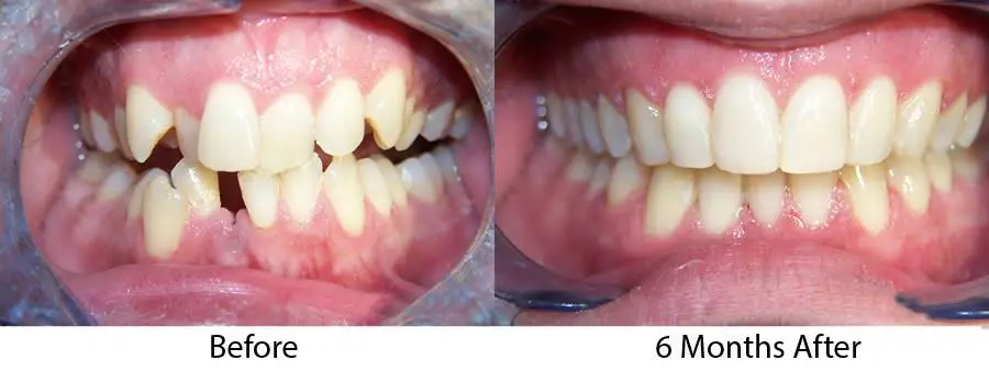Cleveland Circle Dental Associates