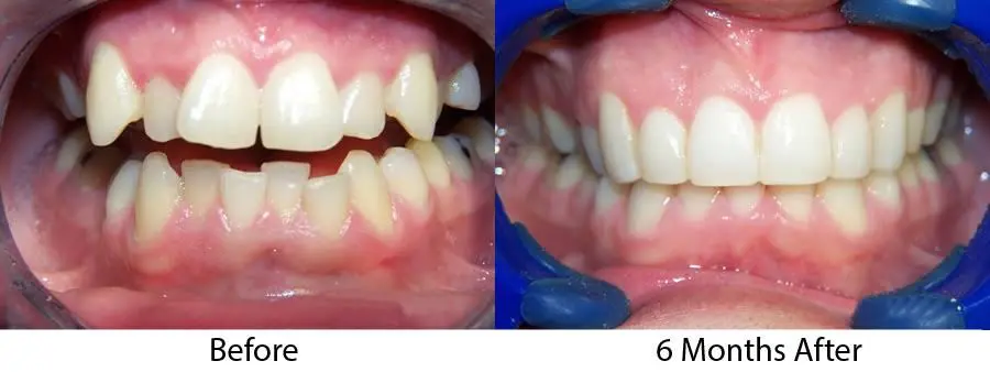 Cleveland Circle Dental Associates