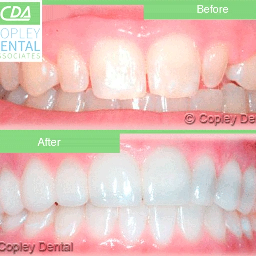 Copley Dental Associates