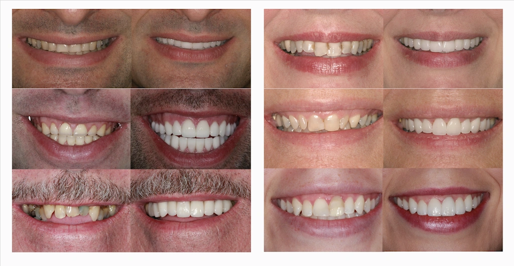 Perfect Smiles