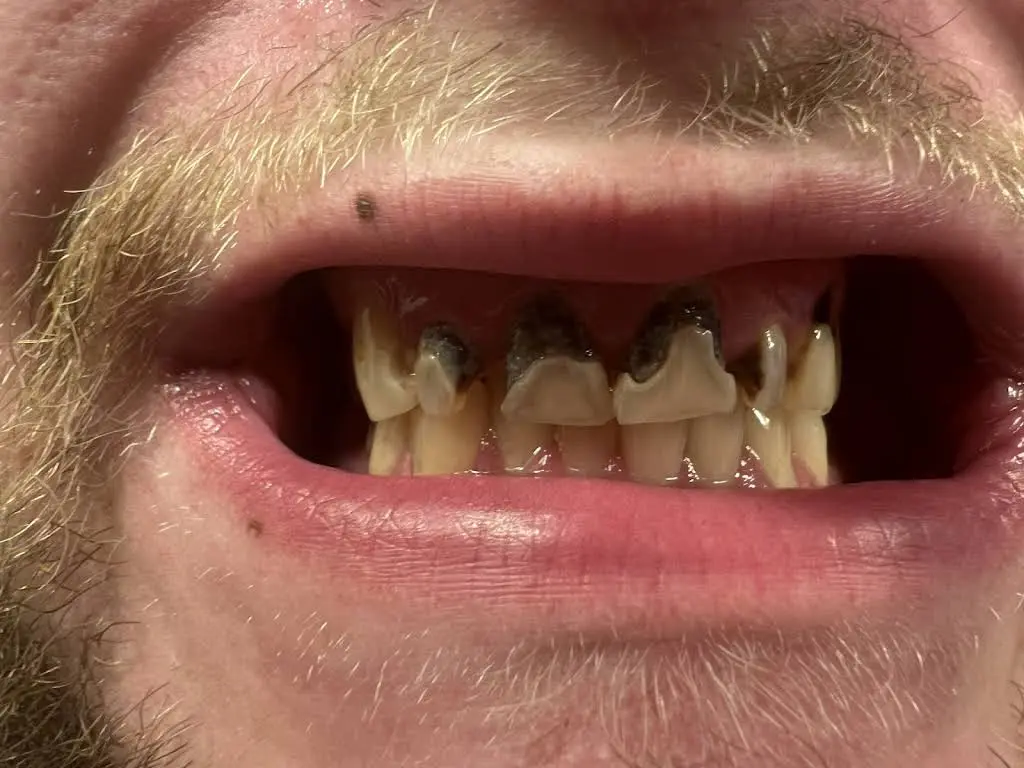 Dental Dreams