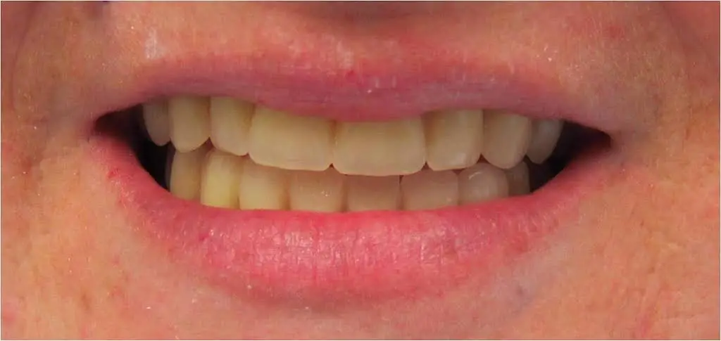 Dental Aid 1