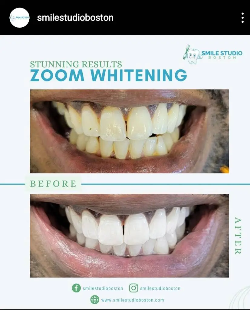 Smile Studio Boston