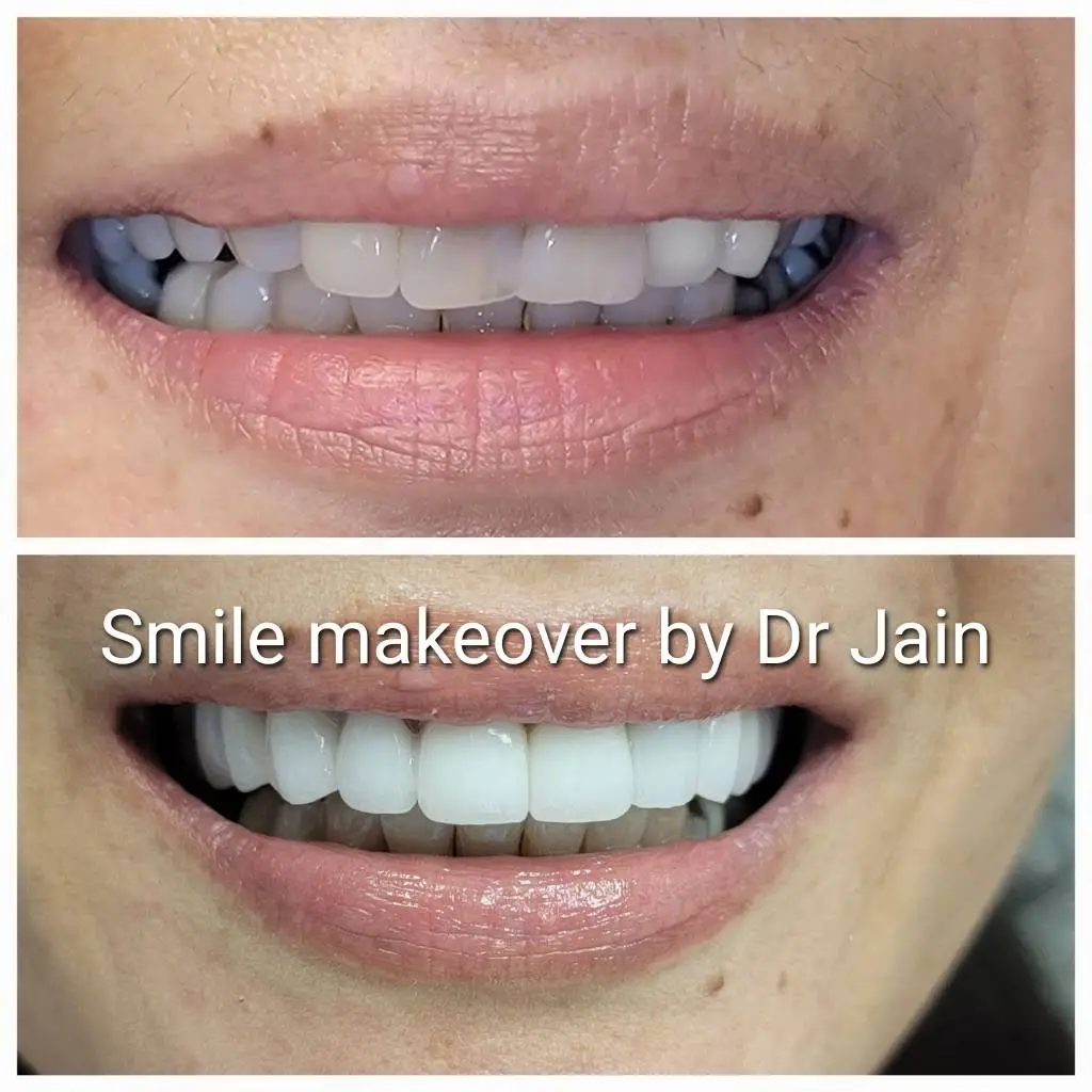 Smile Studio Boston