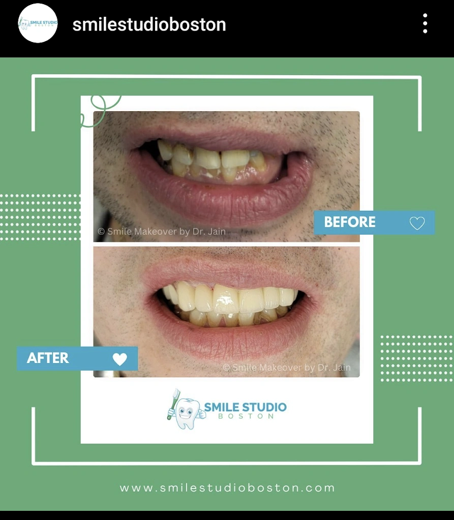 Smile Studio Boston
