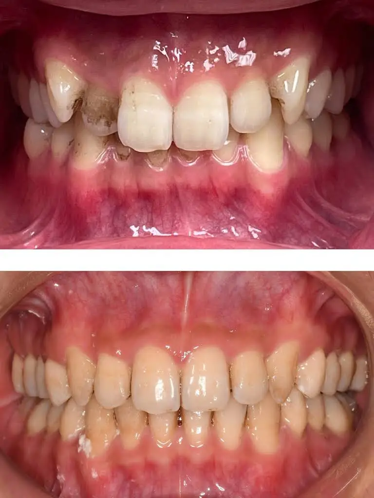 Ascend Dental Studio PLLC