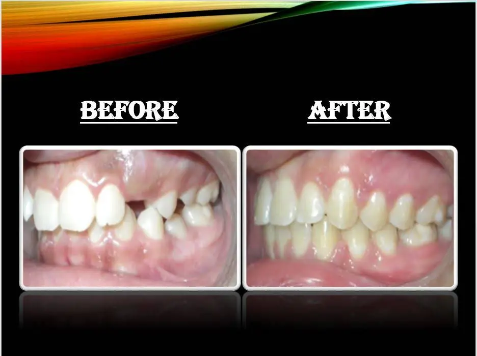 Revere Dental And Orthodontics