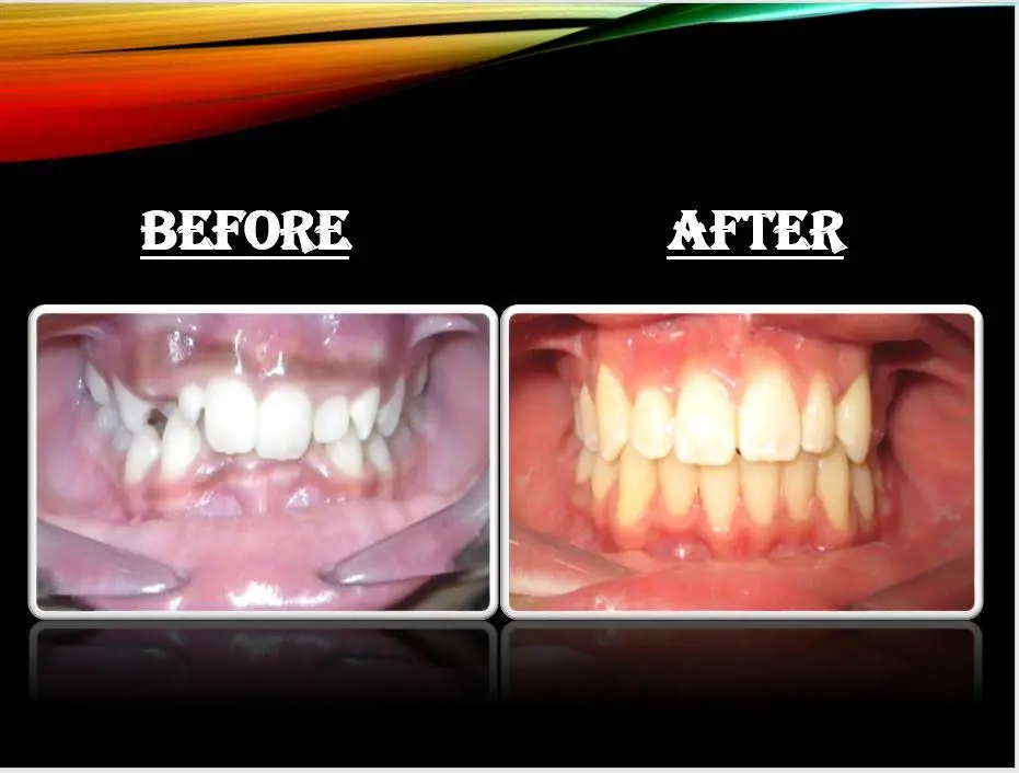 Revere Dental And Orthodontics