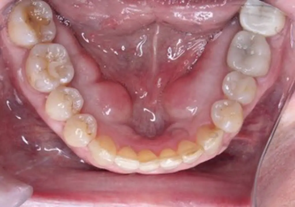 Boschetti Dental, PC