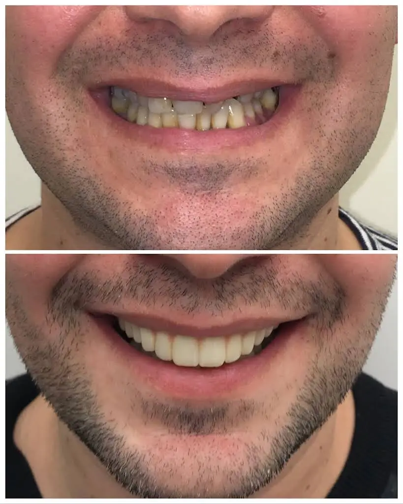 DENTOLOGY Implants TMJ Dentist