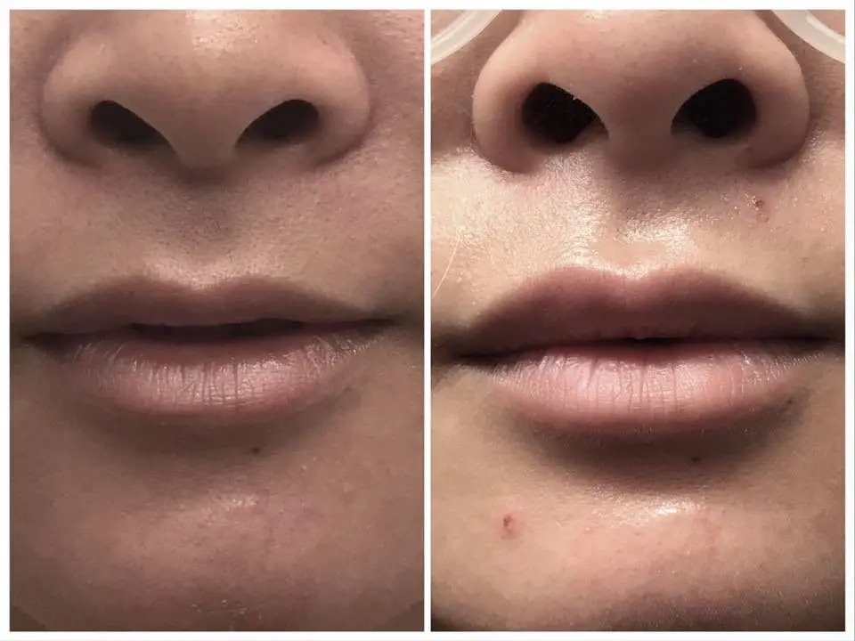 DENTOLOGY Implants TMJ Dentist