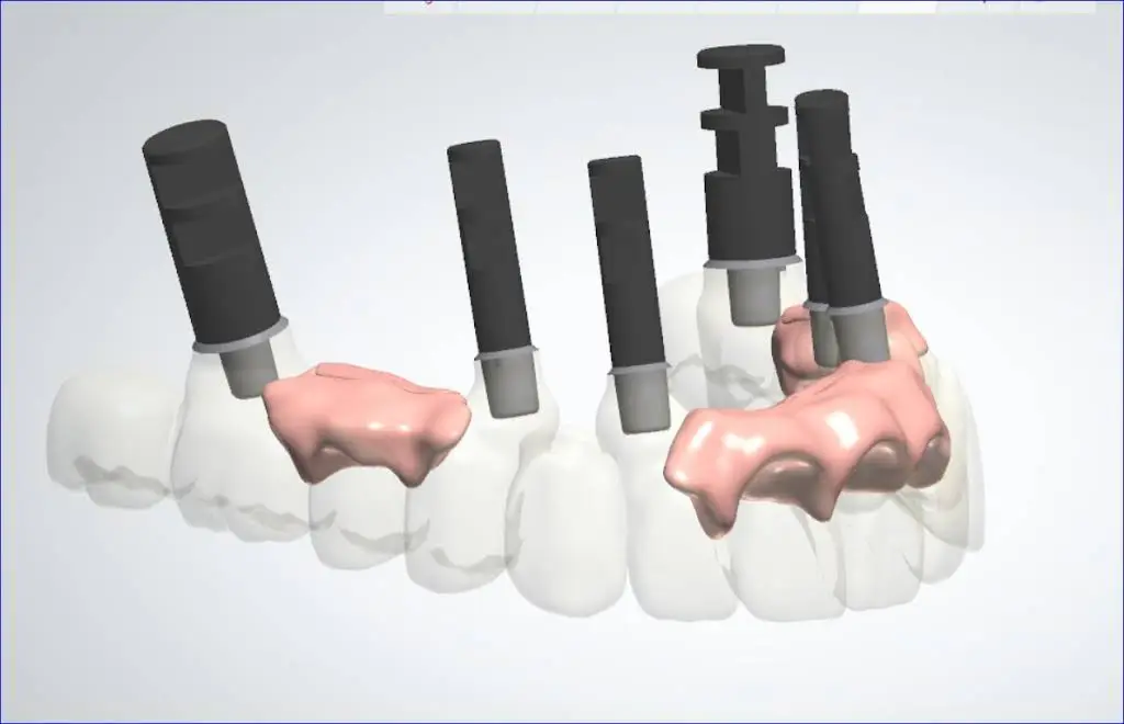 DENTOLOGY Implants TMJ Dentist