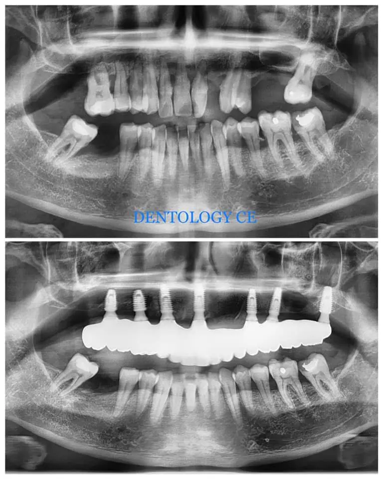 DENTOLOGY Implants TMJ Dentist