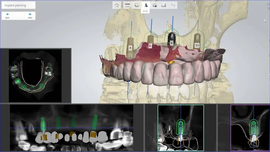 DENTOLOGY Implants TMJ Dentist
