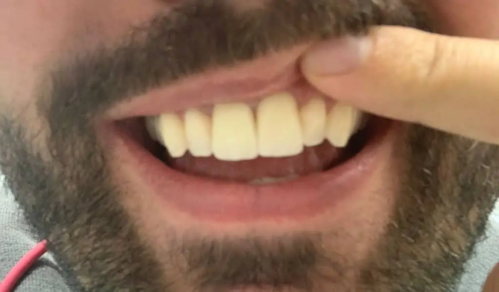 Alpha Dental Somerville