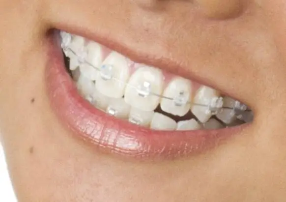 Silversmith Orthodontics