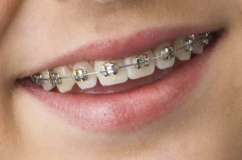 Silversmith Orthodontics