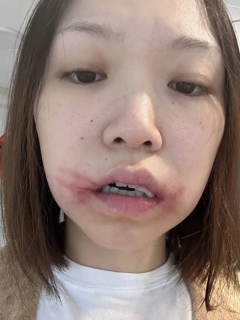 Belmont Oral, Facial & Implant Surgery