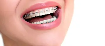 Belmont Smiles