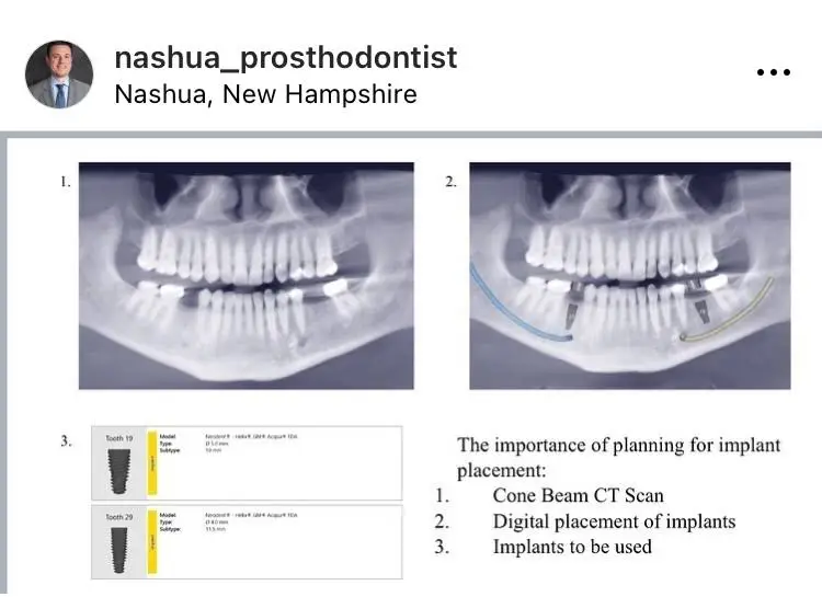 Nashua Prosthodontist Thomas Suranyi DDS MS